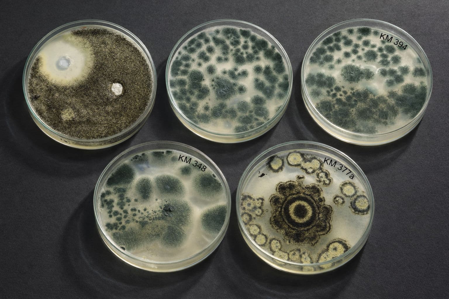 Microbial Culture Analysis